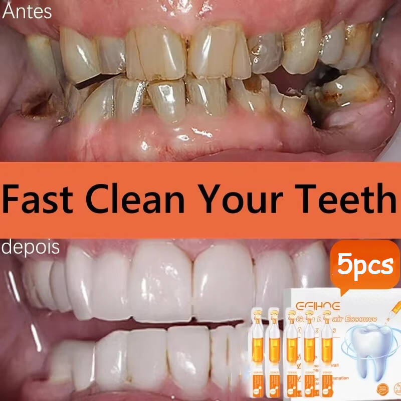 Teeth Whitening Baking Soda - すぐに修復ガム血清後退する歯茎の再成長を和らげるドロップ歯を白くする黄色のプラークの汚れを除去虫歯歯痛歯磨き粉