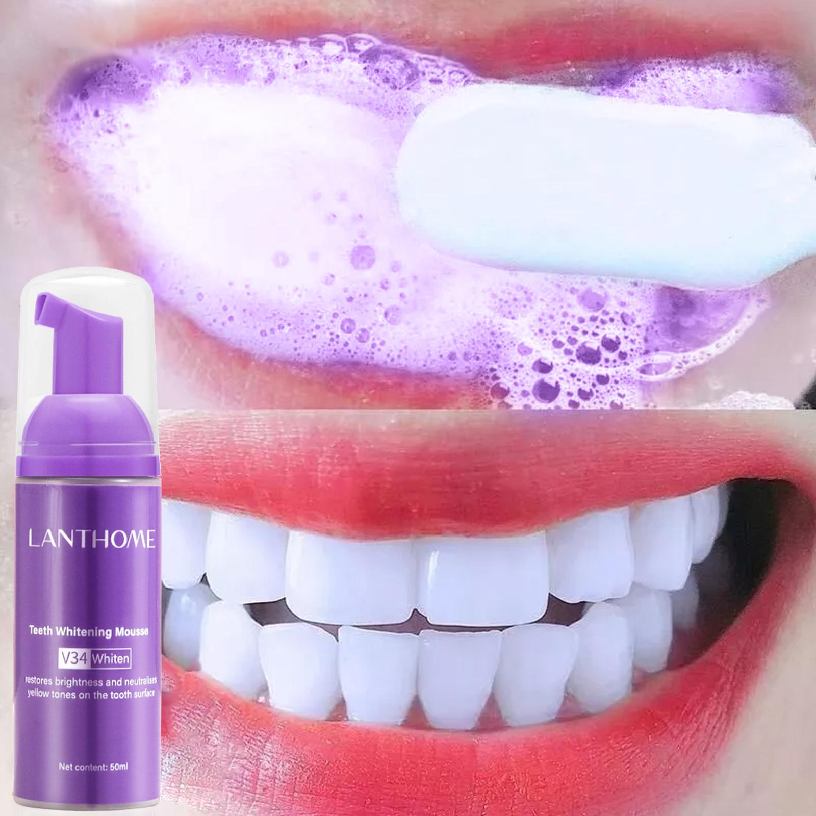 Teeth Whitening Best - V34 ムース歯クリーニング歯磨き粉効果的な美白歯の除去深い美白汚れ黄色口腔歯磨き粉ケア
