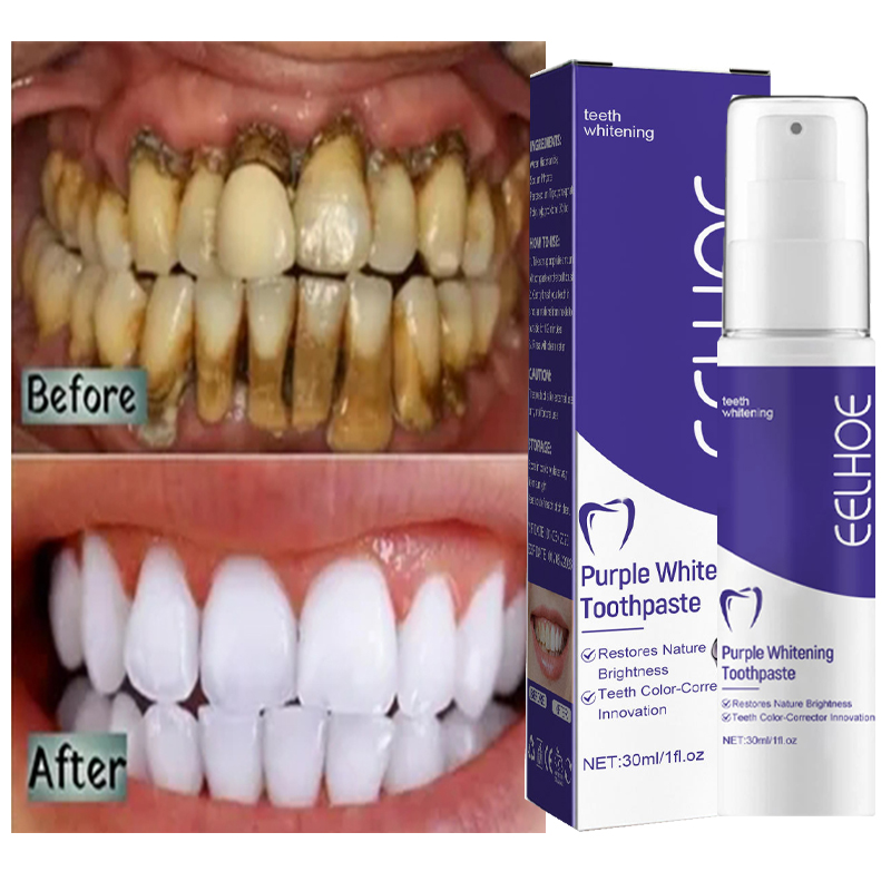 Teeth Whitening In Korea - 歯のホワイトニングジェルパッチ,ホワイトニング用漂白剤,汚れをきれいにする,韓国製品,1ユニット