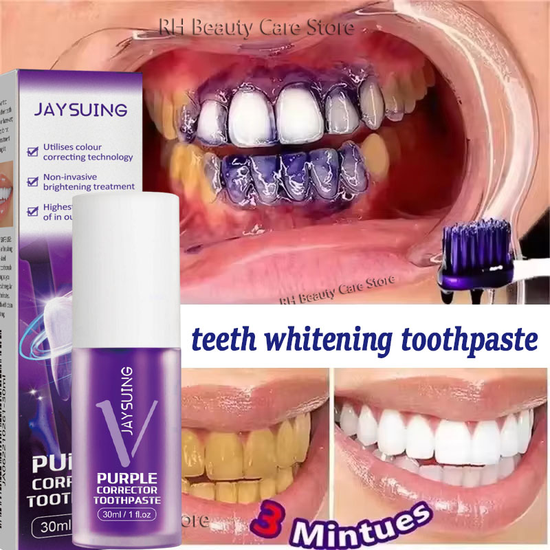 Teeth Whitening In Korea - 歯のホワイトニング歯磨き粉、ホワイトニングジェル、ホワイトナー、漂白剤、汚れ除去、息の臭い除去、歯のクリーニング、韓国製品