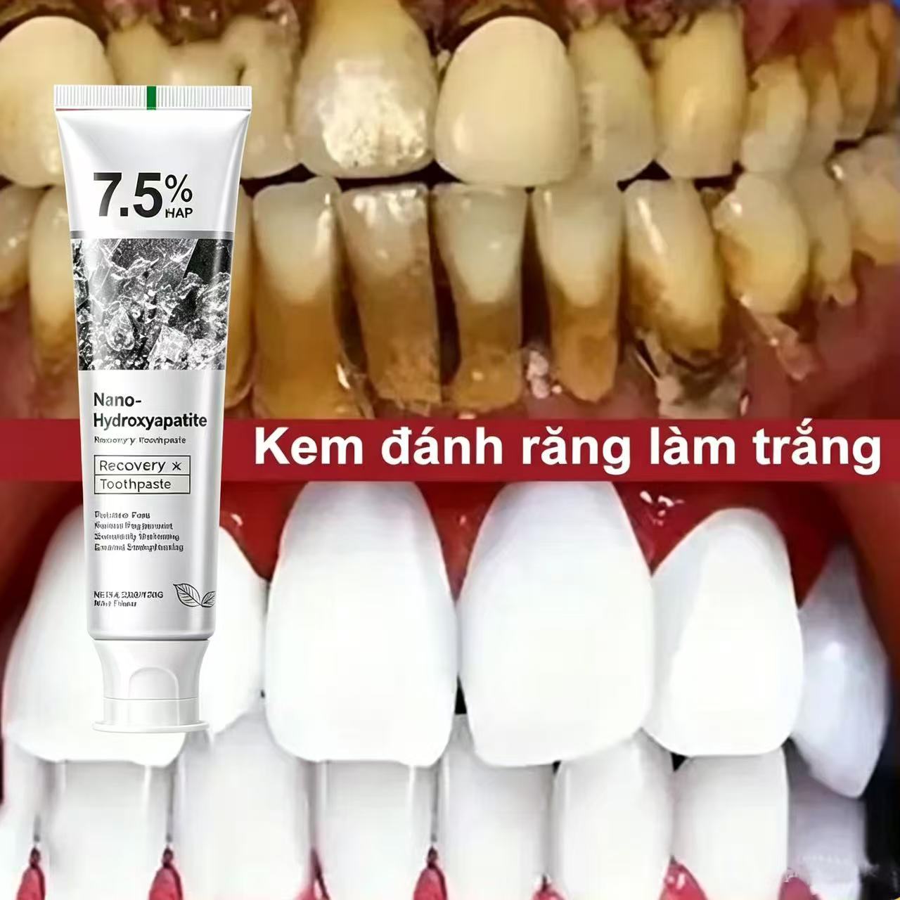 Teeth Whitening Best - 7.5% ハイドロキシアパタイトプロバイオティクスホワイトニング歯磨き粉エナメル口腔修復口臭清涼歯ホワイトナー歯磨き粉 120 グラム