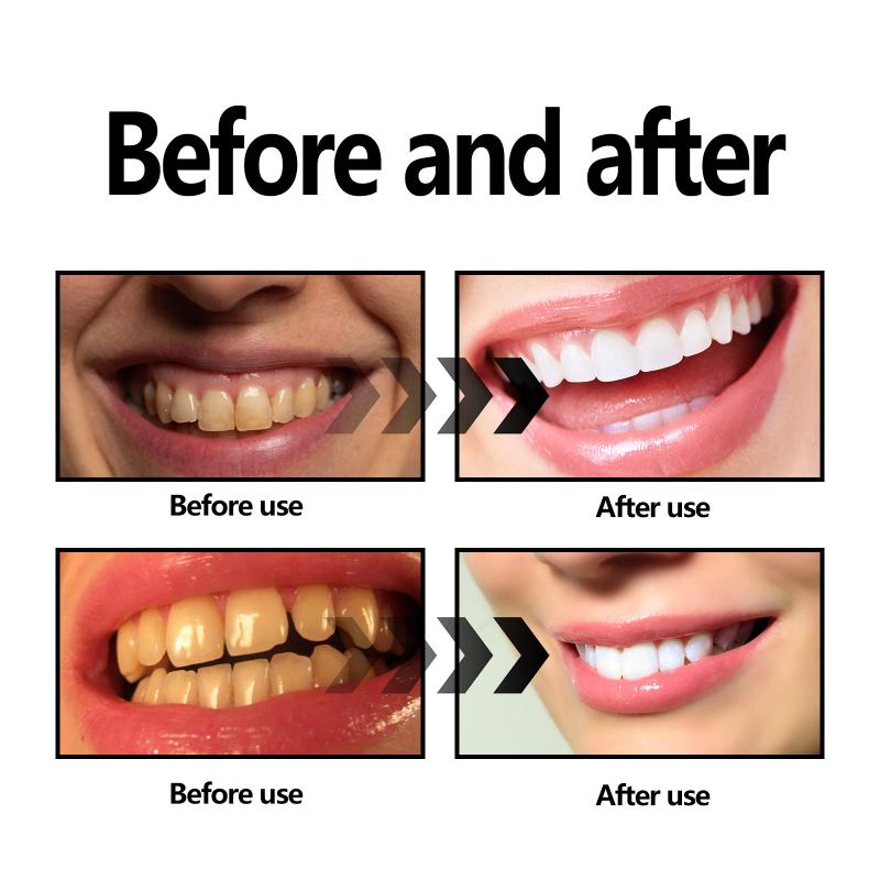 歯のホワイトニングパウダー チャコール/重曹歯のホワイトニン - Teeth Whitening Baking Soda のレビューと価格