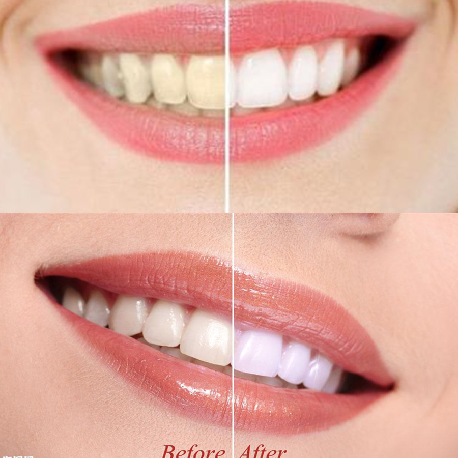竹炭歯,口腔衛生,煙のホワイトニング,新鮮な呼吸のための歯の - Teeth Whitening Quotes のレビューと価格