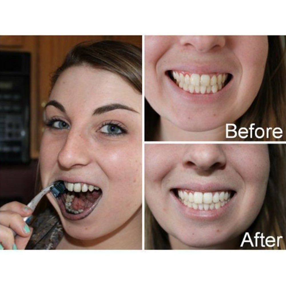 竹炭歯,口腔衛生,煙のホワイトニング,新鮮な呼吸のための歯の - Teeth Whitening Quotes のレビューと価格
