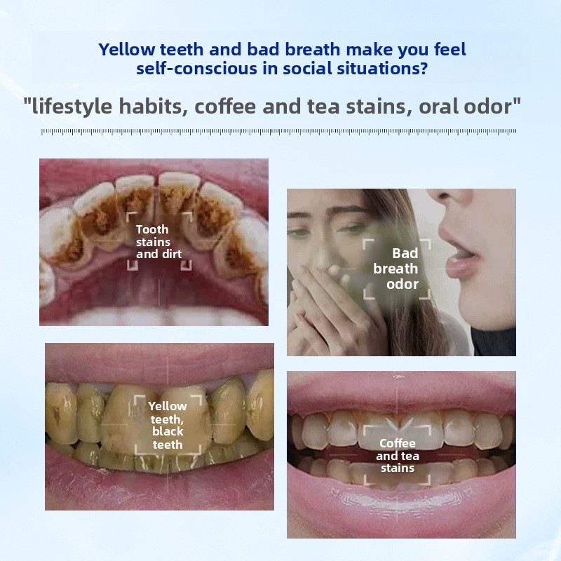 酵素配合の歯磨き粉で、健康な歯と歯茎を保護し、息を爽やかにす - Teeth Whitening Enzymes のレビューと価格