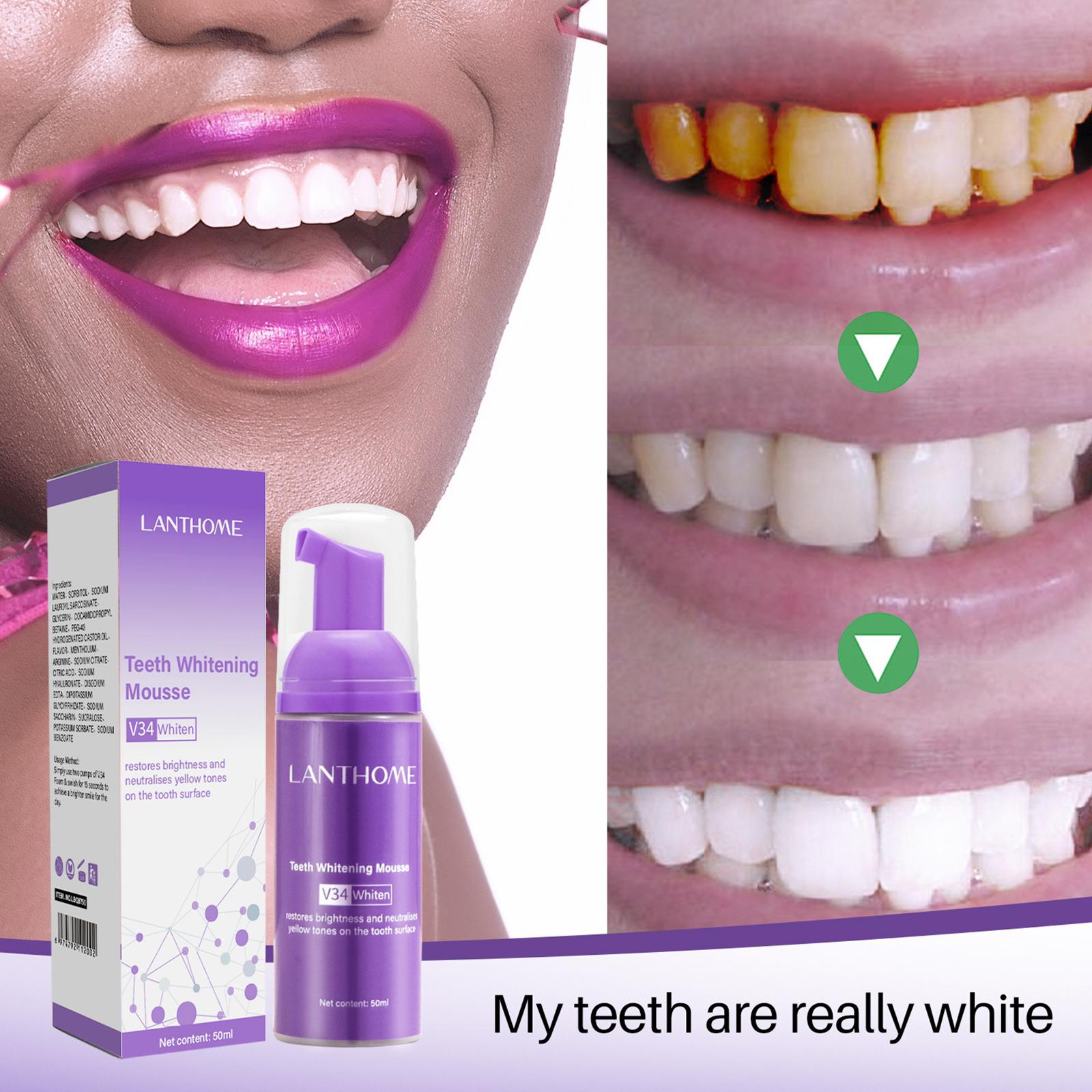 V34 ムース歯クリーニング歯磨き粉効果的な美白歯の除去深い - Teeth Whitening Best のレビューと価格