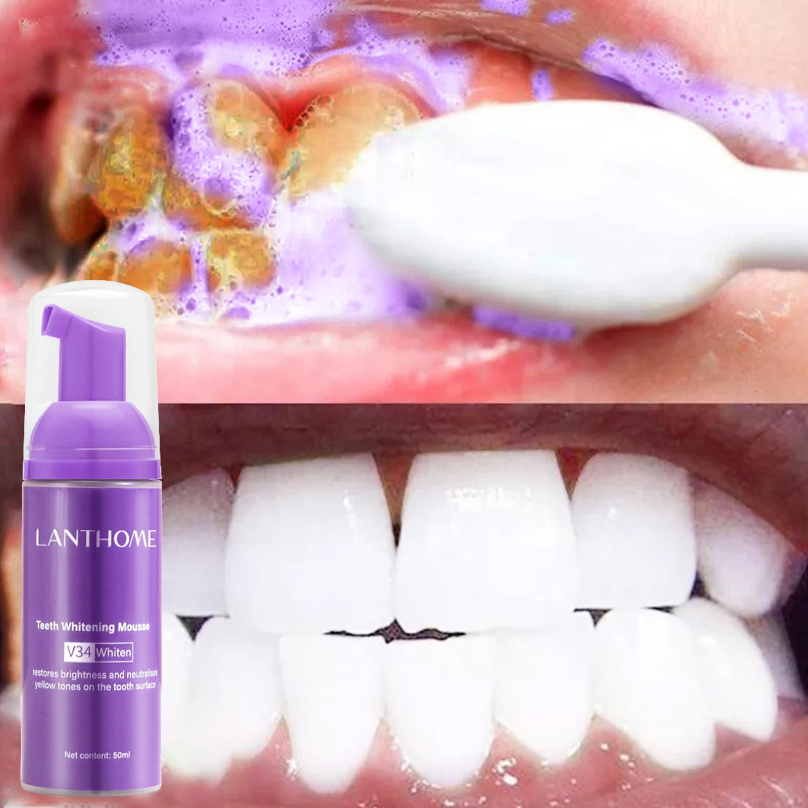 V34 ムース歯クリーニング歯磨き粉効果的な美白歯の除去深い - Teeth Whitening Best のレビューと価格
