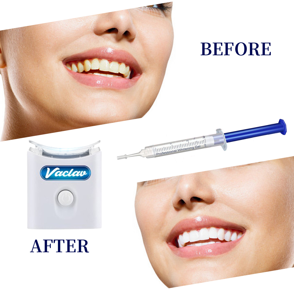 ミント歯のホワイトニングジェルシリンジホーム歯のホワイトニン - Teeth Whitening Baking Soda のレビューと価格
