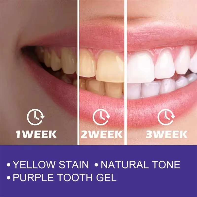 歯のクリーニングホワイトニング歯磨き粉ホワイトニングジェルホ - Teeth Whitening In Korea のレビューと価格