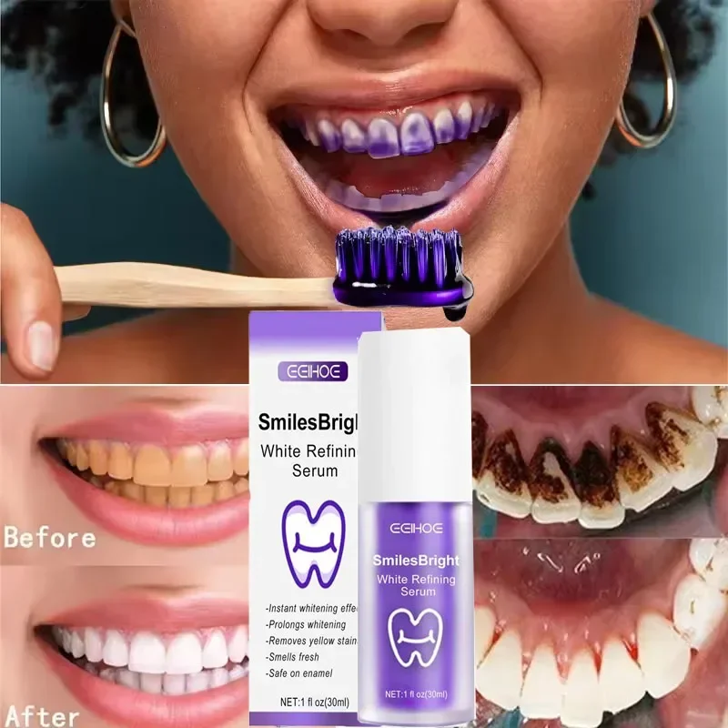 歯のクリーニング ホワイトニング歯磨き粉 ホワイトニングジェ - Teeth Whitening In Korea のレビューと価格