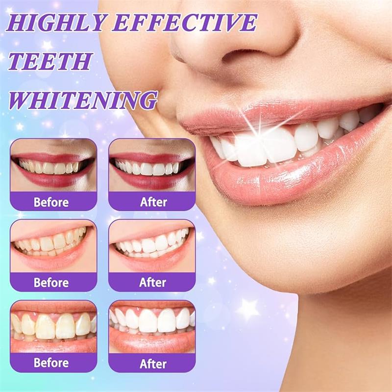 9D パープル歯磨き粉ムース 黄ばんだ歯の汚れ除去用集中ステ - Teeth Whitening Best のレビューと価格