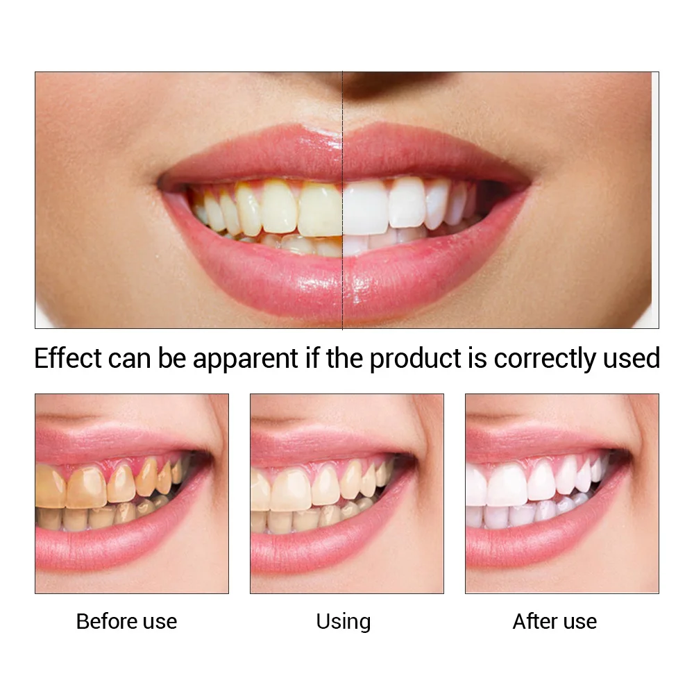 歯のホワイトニングエッセンス,口腔衛生,歯のホワイトニング, - Teeth Whitening Quotes のレビューと価格