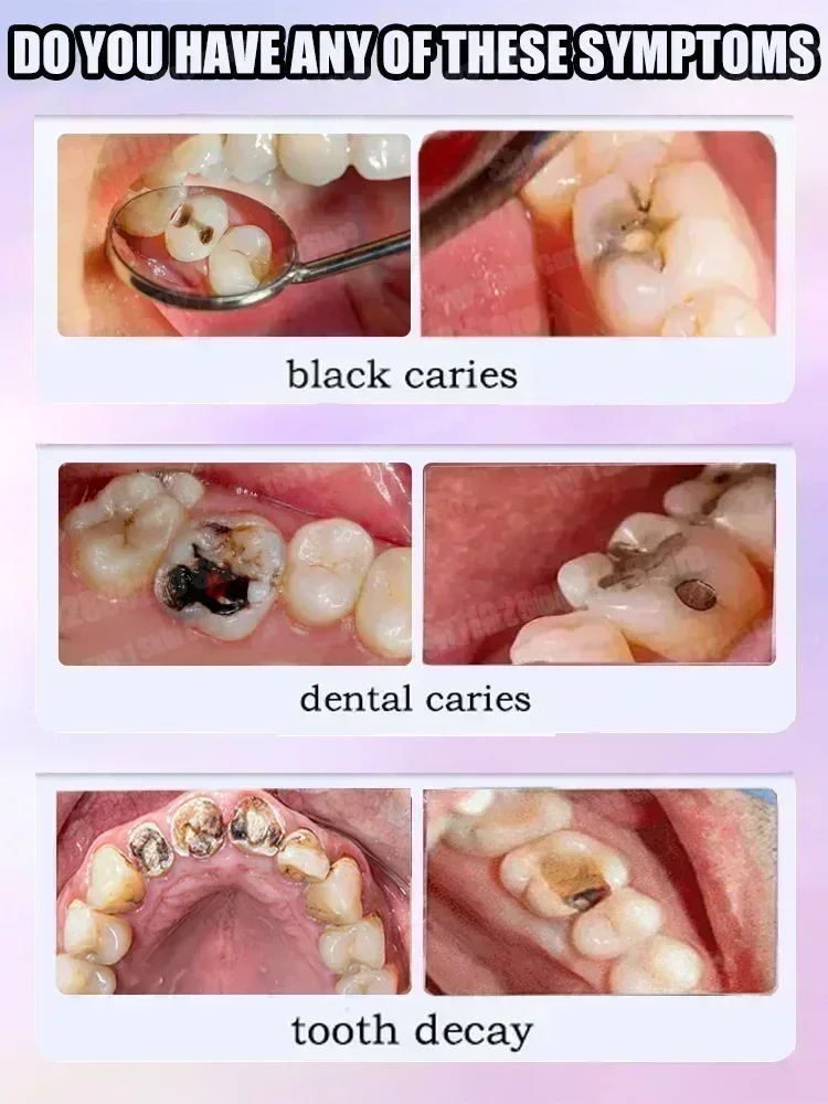 ホットセールのベストセラー、科学的修復虫歯、虫歯の除去、歯垢 - Teeth Whitening Best のレビューと価格