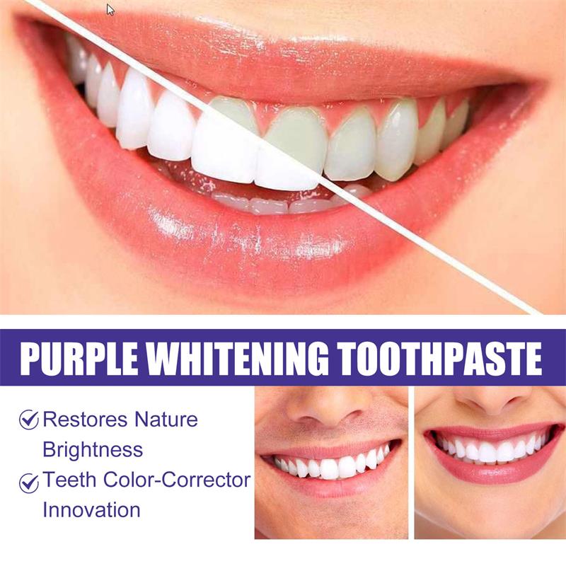 歯のホワイトニング歯磨き粉、ホワイトニングジェル、ホワイトナ - Teeth Whitening In Korea のレビューと価格