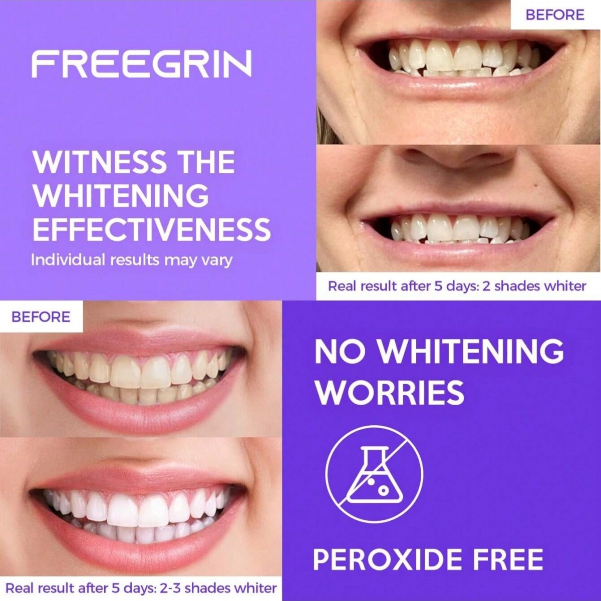 デラックスホワイトニング歯ステッカー 7/14/21 ペアジ - Teeth Whitening Quotes のレビューと価格
